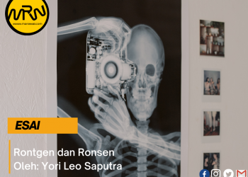 Yori Leo Saputra | Rontgen dan Ronsen